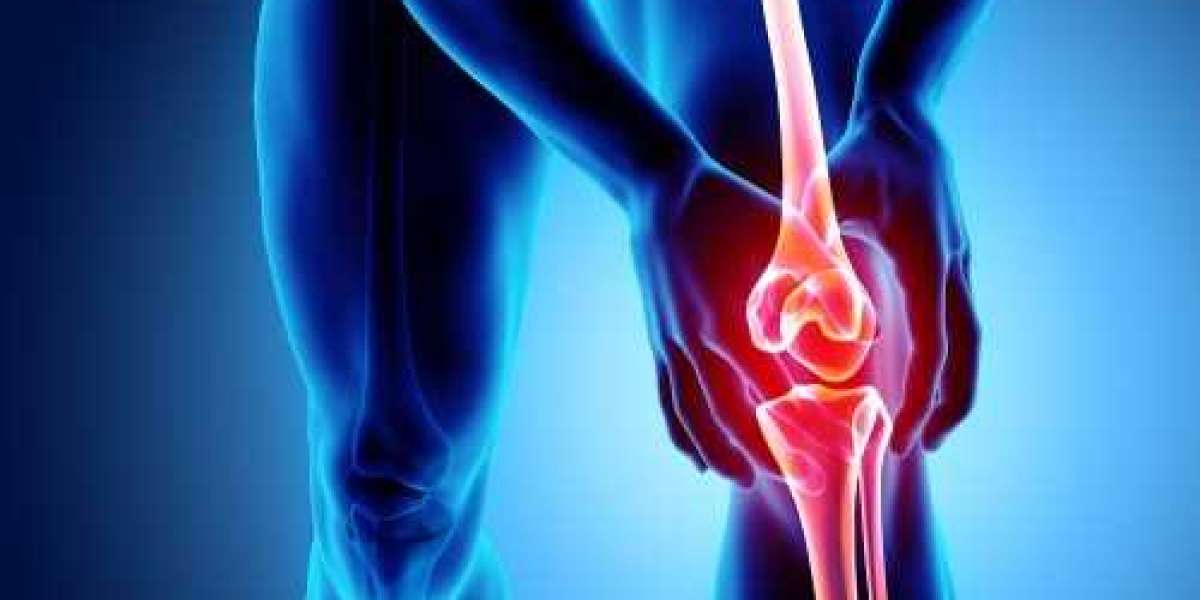 Knee Conditioning Program