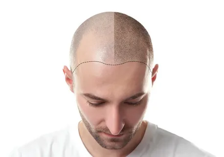 Following profile image
