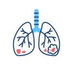 Lung Cancer Chennai Profile Picture