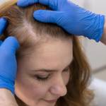 haircare clinic Profile Picture