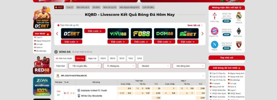 Kqbd loan cover